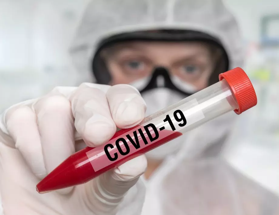 COVID-19 и в Изпълнителна агенция „Медицински надзор“ 