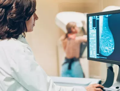 Мамографията спасява животи: Защо е добре да ходите често на профилактика