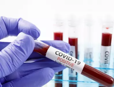 Учен се заразява два пъти с коронавирус заради експерименти 