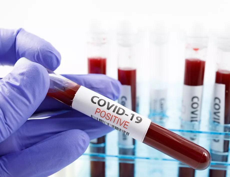 Над 1000 вече станаха диагностицираните с COVID-19 в Област Русе 