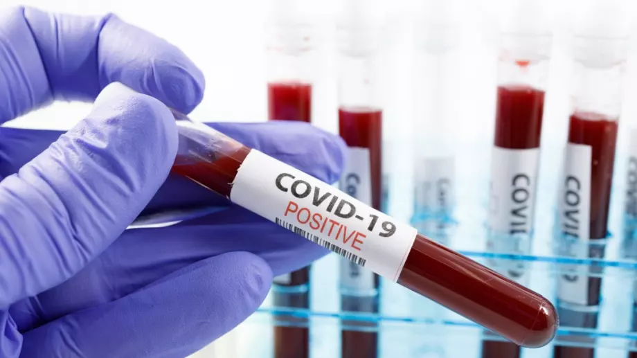 Висок остава броят на заразените с коронавирус за денонощие у нас