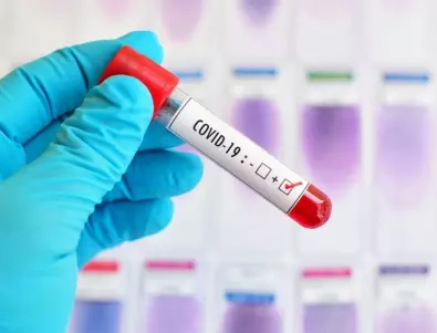 Изследване: Има кръвна група с по-нисък риск за заразяване с COVID-19