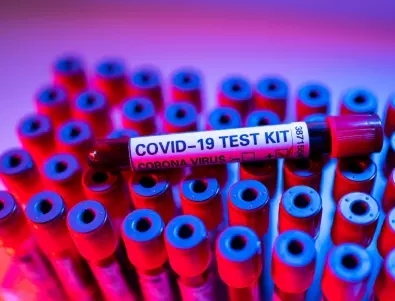 Лек спад на случаите с коронавирус в Чехия