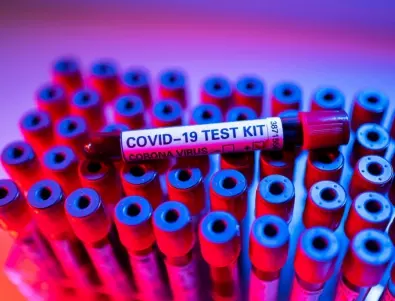 Ново изследване: Асимптоматичните с коронавирус носят по-голямо количество вируси