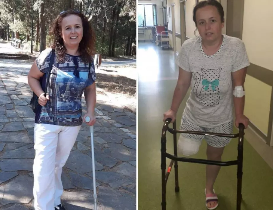Млада жена с рак на костите и ампутиран крак се нуждае от средства за протеза