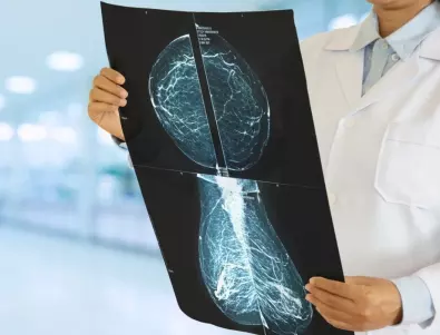 Абсурд: Все още не може да се ползват преносимите рентгени, получени с евросредства