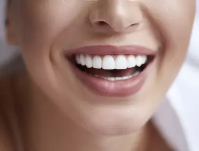 Мощно избелване на зъбите в домашни условия