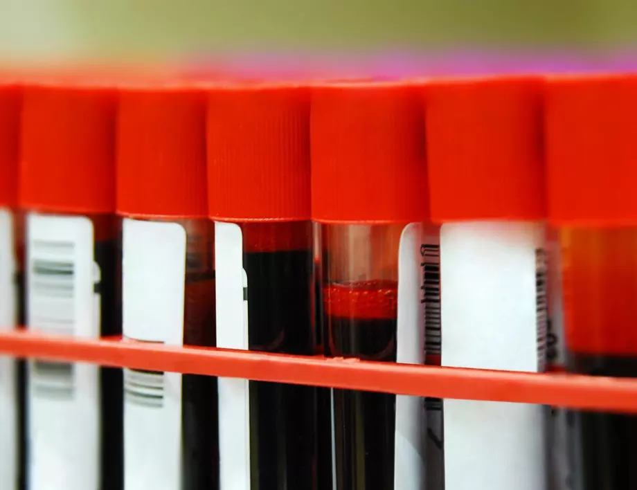 Може ли рак да бъде открит с кръвен тест?
