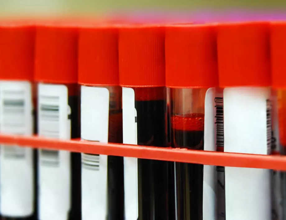 Психолог разкри как кръвната група определя съдбата на човек