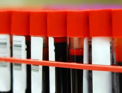 Учени: Хората с тази кръвна група живеят повече от останалите