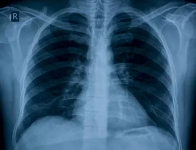 Лекар каза как можете да имате здрави бели дробове и сърце до 100 годишна възраст