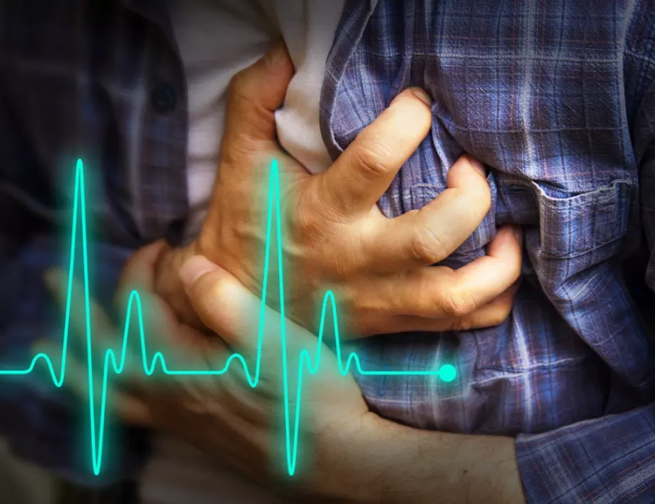 7 факта за инфаркта, които всеки трябва да знае