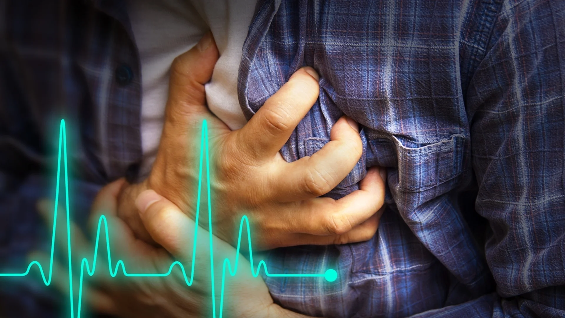 Живот след инфаркт: Лекар разкри какво трябва и какво НЕ трябва да се прави