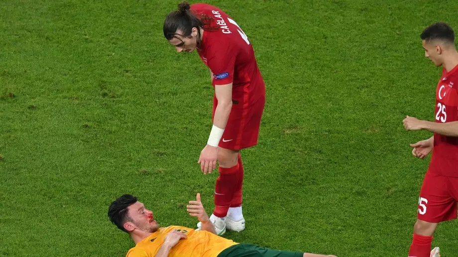 Разбиха главата на бранител на Уелс във втори пореден мач на Евро 2020 (СНИМКА)