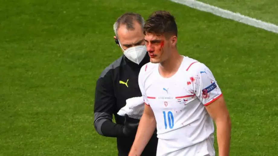 "Кървав гол" на Евро 2020 - Патрик Шик с трето попадение за Чехия