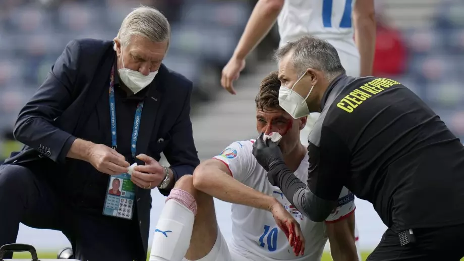 Патрик Шик призна, че диша трудно след разбиването на носа му срещу Хърватия