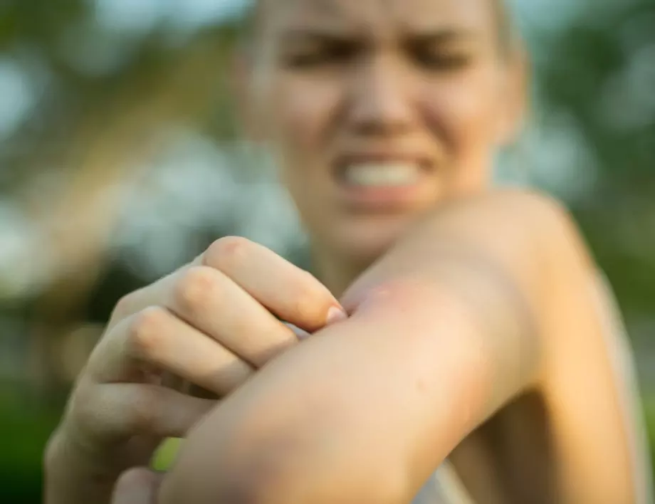 7 причини комарите да ви хапят по-често от другите