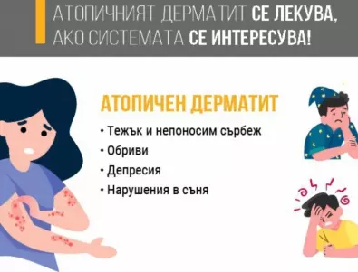 Само в България от целия ЕС държавата не заплаща лечението за атопичен дерматит 