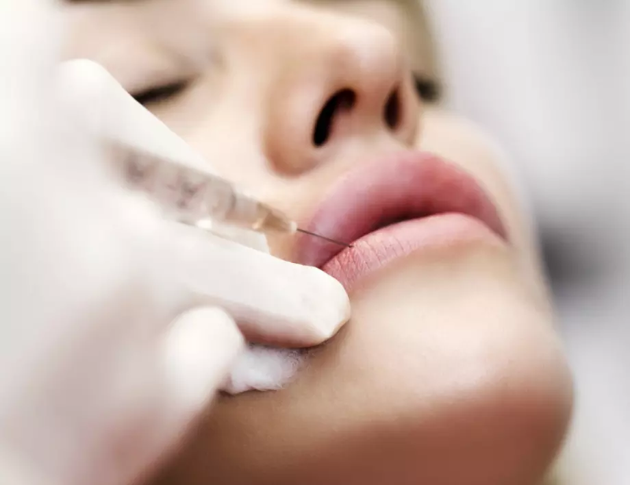 7 неща, които трябва да знаеш за хиалурона в устните, преди да се боцнеш 