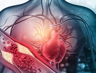 Висок холестерол и проблеми със сърцето – какво да направите, за да ги избегнете