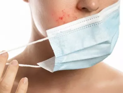 Как да предпазим кожата си от дразненето на маските