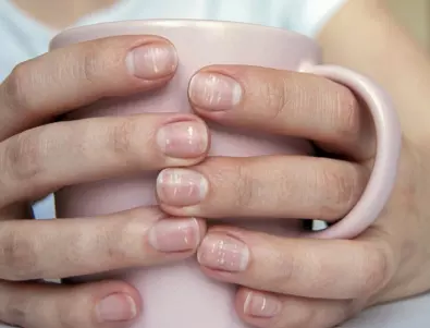 7 сигнала по ноктите, които показват здравословни проблеми