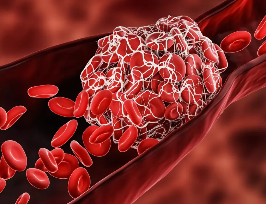 3 eвтини храни, които предпазват от кръвни съсиреци
