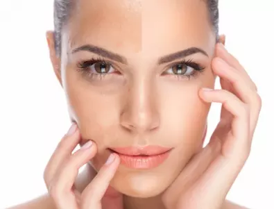 5 начина да спрете стареенето на кожата