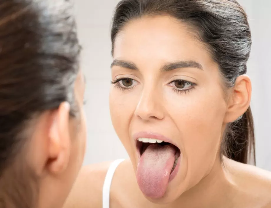 Внимавайте: Червените петна по езика може да са симптом на...