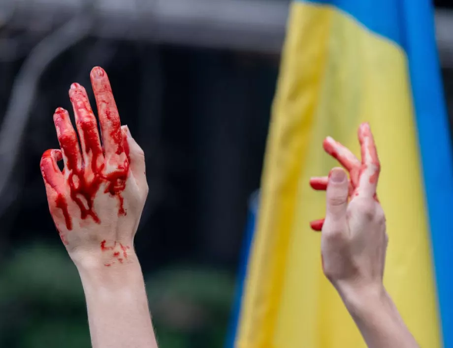 МВнР на Украйна: Паспорт спаси момче от смърт от шрапнел (СНИМКА)
