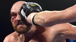 {{ otherArticle[0].article.title }}