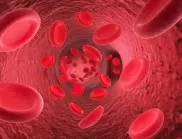 Нисък хемоглобин: Лекар разкри кои са най-лесните начини за повишаването му