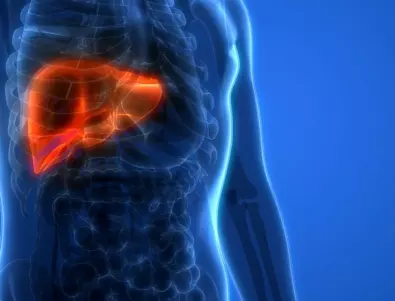 Лекари: Цирозата на черния дроб се проявява с тези 3 симптома