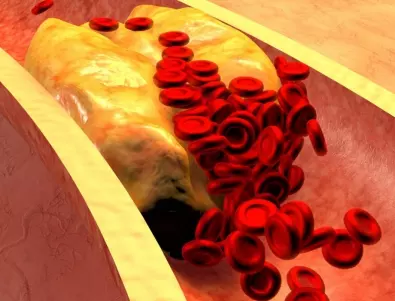 Учени: Яжте тази ядка всеки ден и вижте какво ще се случи с холестерола ви