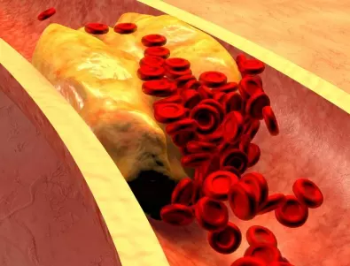 16 храни, които отпушват артериите и предпазват от инфаркт