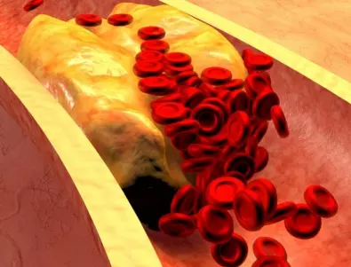 Учени откриха свойство на холестерола, за което дори не предполагате