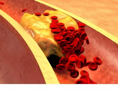 6 начина да намалите холестерола си по естествен път