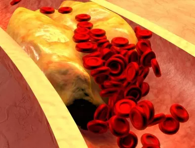 Учени: Тази салата сваля кръвното, захарта и холестерола
