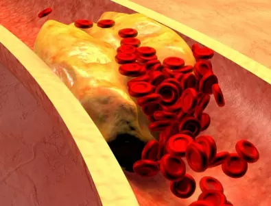 Учени: Тези 5 храни са най-добри за холестерола