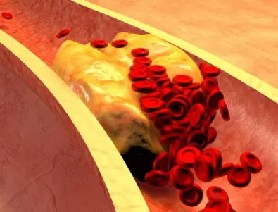 Митове и факти за холестерола, които всички трябва да знаят