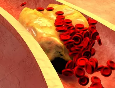 Магнезий - как влияе на холестерола
