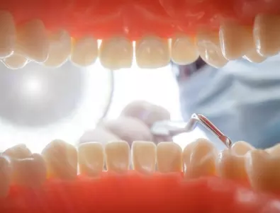 Лекар: Едва ли предполагате, че развалените зъби водят от тези заболявания