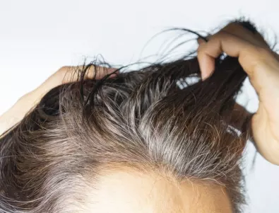 Учени: Ранното побеляване на косата издава проблем с този орган