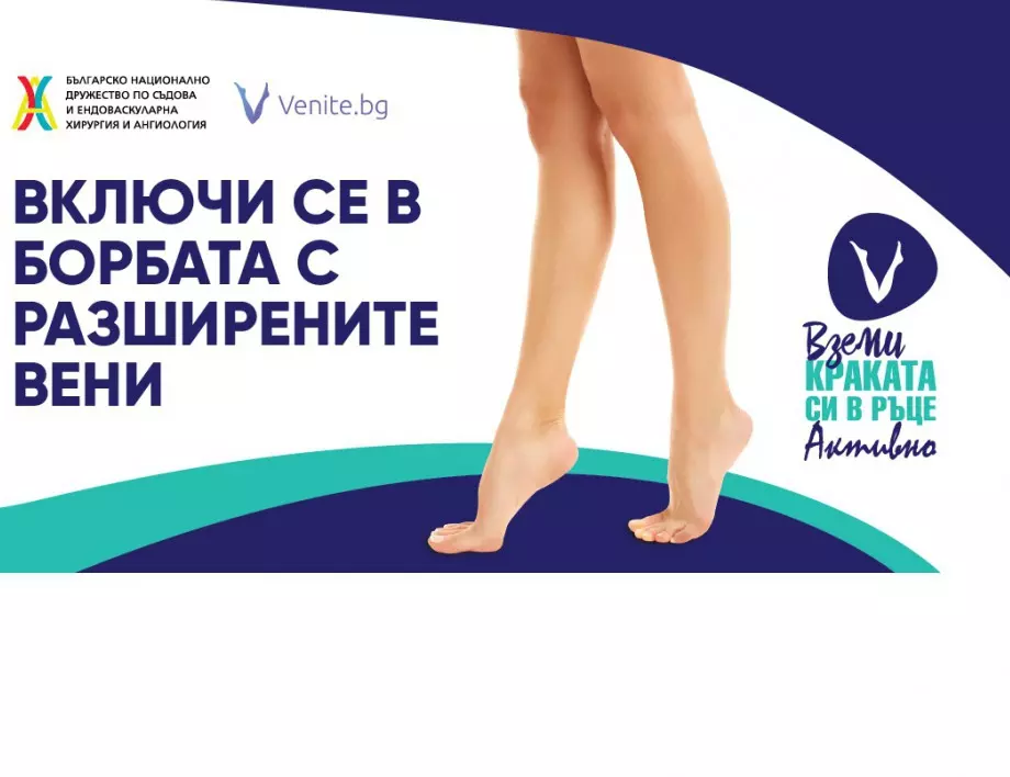 Националната кампанията „Вземи краката си в ръце активно“ поставя фокус върху навременното диагностициране на хроничната венозна болест