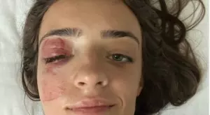 На Световното: Изабела Янкова падна тежко, показа последствията (ВИДЕО)