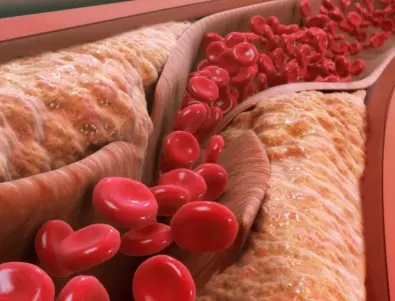 5 храни, които ядем рядко, но те свалят холестерола и лекуват сърцето
