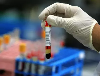 Обещаха нови лаборатории за по-бързо изследване на алкохол и наркотици в кръвта