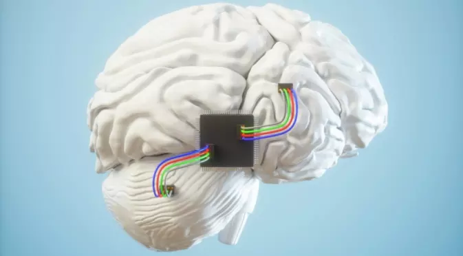 Първият човек с чип на Neuralink в мозъка игра онлайн шах във видео стрийминг (ВИДЕО)