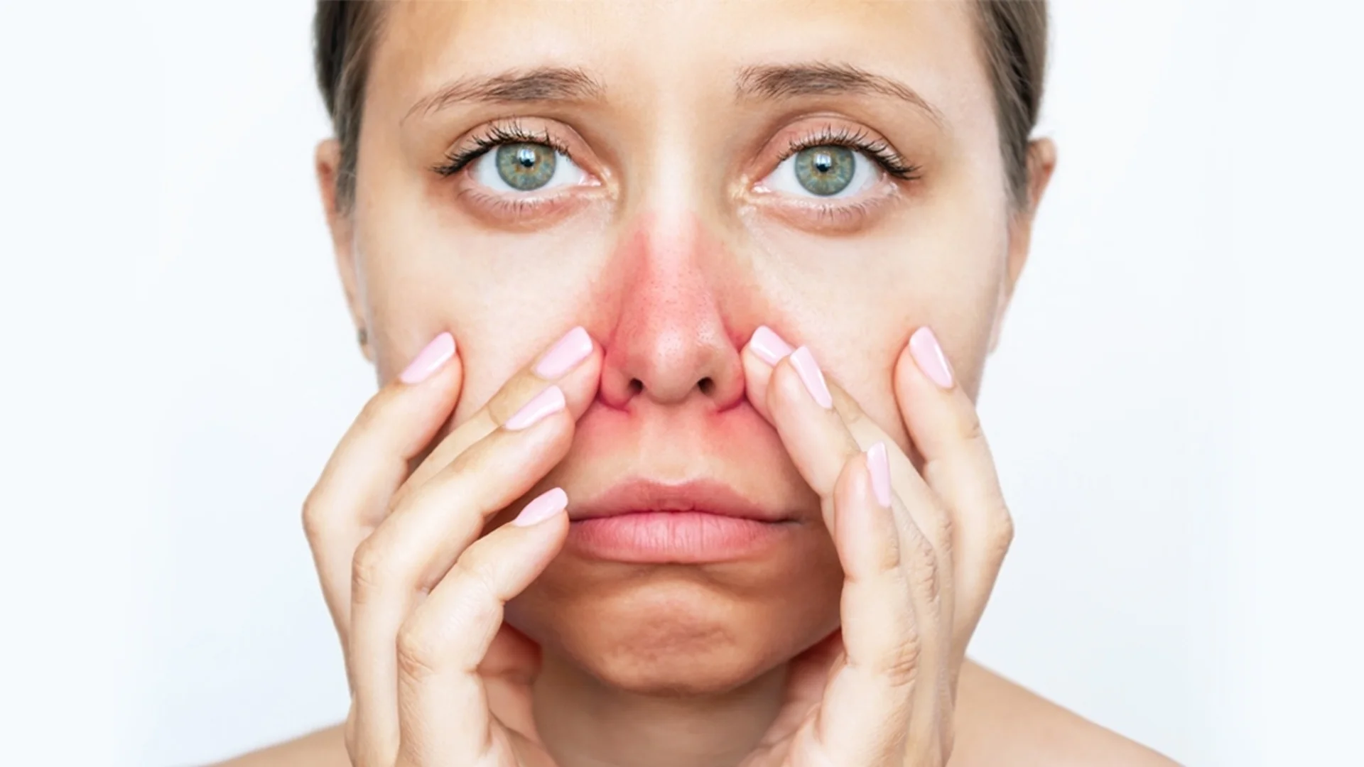 Диагноза: Алергичен ринит. Какви опасности крие и как да се справим с течащия или запушен нос?
