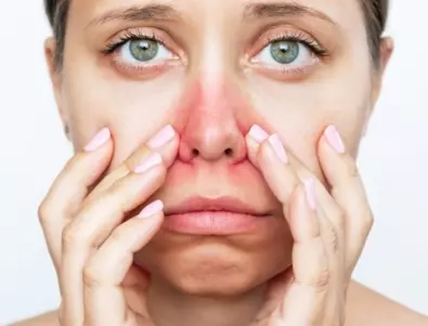 Диагноза: Алергичен ринит. Какви опасности крие и как да се справим с течащия или запушен нос?